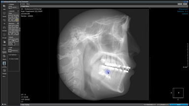 X-ray generator (2D Image and report generation)